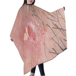 Personality  Exploded Pimple Hair Cutting Cape