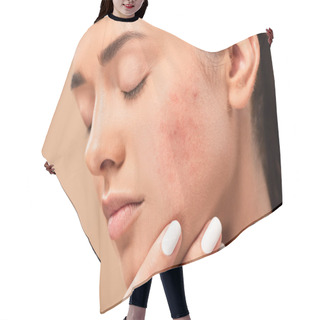 Personality  Young Woman With Closed Eyes Touching Face With Acne Isolated On Beige  Hair Cutting Cape