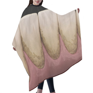 Personality  Tartar And Bactrail Tooth Plaque, Lower Jaw. Medically Accurate 3D Illustration Of Human Teeth Treatment Hair Cutting Cape