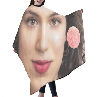 Personality  Girl Face With A Zoom On The Skin Showing The Signs Of Rosacea Hair Cutting Cape
