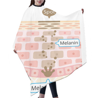 Personality  Human Skin Layer Of Melanin And Facial Dark Spots. Infographic Skin Layer Illustration. Beauty And Skin Care Concept Hair Cutting Cape