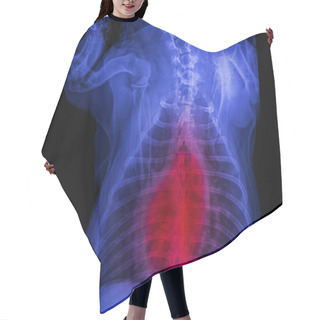 Personality  X-ray Of Dog Posterior View Closed Up In Thorax Standard And Chest With Red Highlight In Respiratory System Signs Of Pneumonia And Bronchitis- Veterinary Medicine And Veterinary Anatomy Concept Hair Cutting Cape