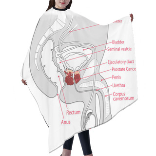 Personality  Cancer Prostate Anatomy Cross Section Illustration Hair Cutting Cape