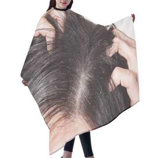 Personality  Dander That Causes Itching Scalp Hair Cutting Cape