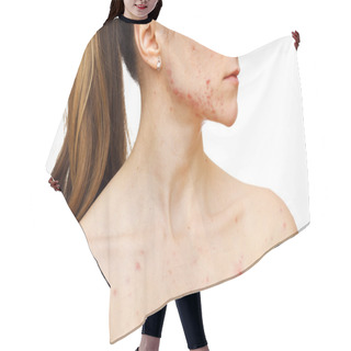 Personality  Skin Problems Hair Cutting Cape