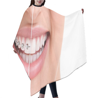 Personality  Healthy Smile With Braces Hair Cutting Cape