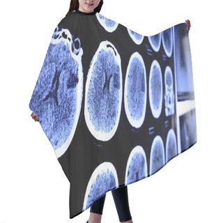 Personality  CT X-ray  Hair Cutting Cape