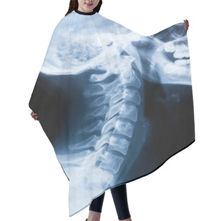 Personality  X-ray Of The Neck And Skull - Side View Hair Cutting Cape