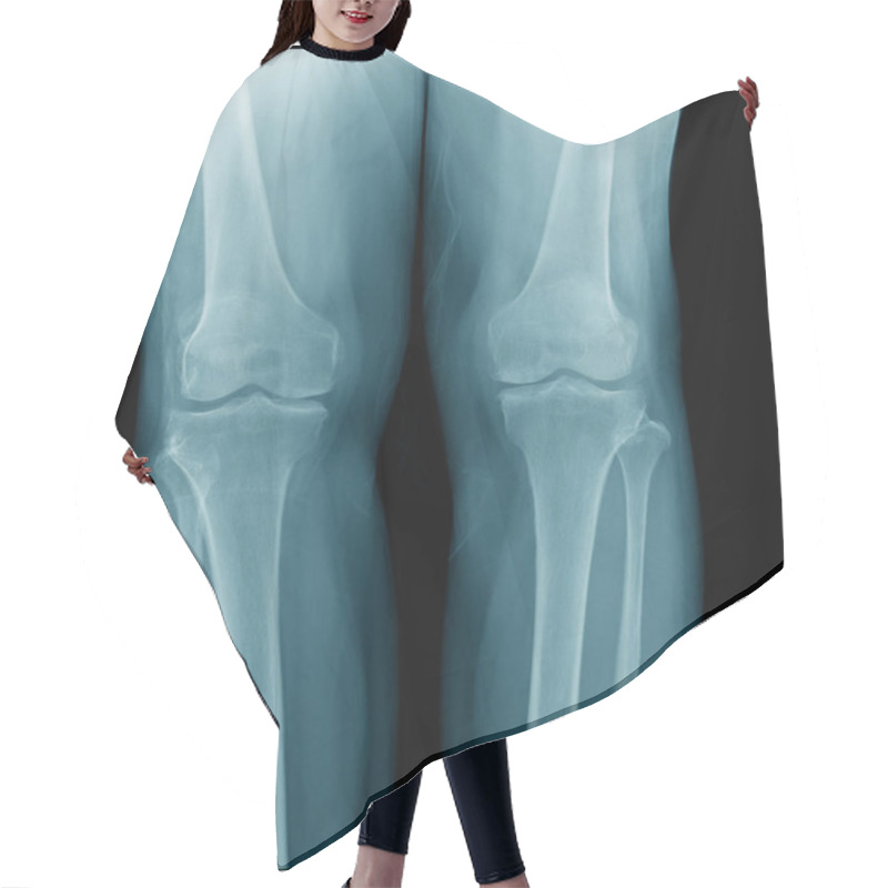 Personality  High Quality X-ray Knee Joint Of Old Man, OA Knee Of Old Man On Black Background In Blue Tone Hair Cutting Cape