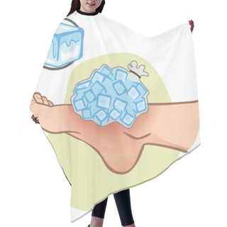 Personality  Illustration Of First Aid Person Caucasian, Foot With Ice Bag, Side View. Ideal For Catalogs, Information And Medicine Guides Hair Cutting Cape