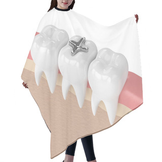 Personality  3d Render Of Teeth With Dental Amalgam Filling Hair Cutting Cape