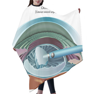 Personality  Cataract Hair Cutting Cape