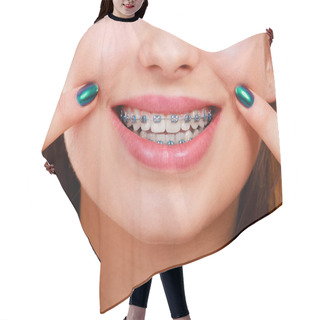 Personality  Dentist And Orthodontist Concept. Woman Smile Showing Her White Teeth With Blue Braces Hair Cutting Cape