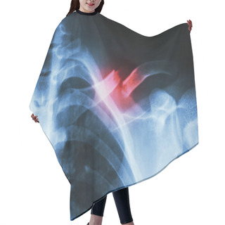 Personality  Fracture Left Clavicle Hair Cutting Cape