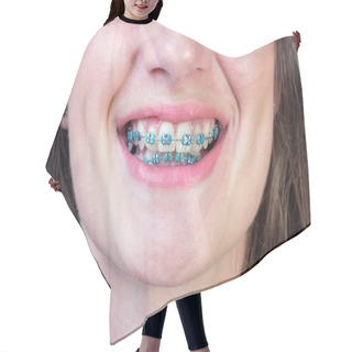 Personality  Dental Braces Hair Cutting Cape
