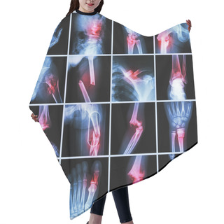 Personality  Collection X-ray Multiple Bone Fracture (finger,spine,wrist,hip,leg,clavicle,ankle,elbow,arm,foot) Hair Cutting Cape