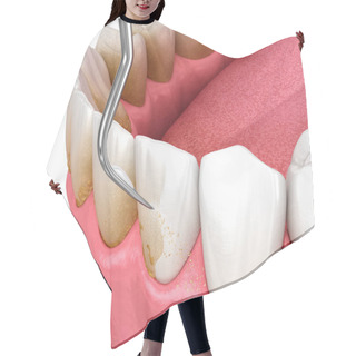 Personality  Oral Hygiene: Scaling And Root Planing (conventional Periodontal Therapy). Dental 3D Illustration Hair Cutting Cape