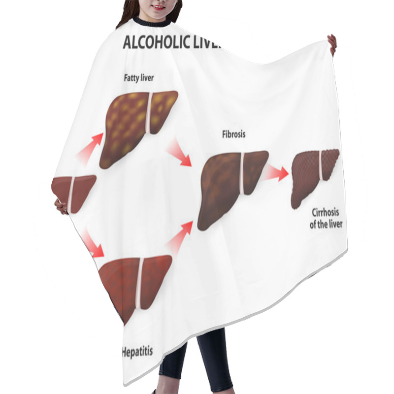 Personality  Alcoholic Liver Disease Hair Cutting Cape