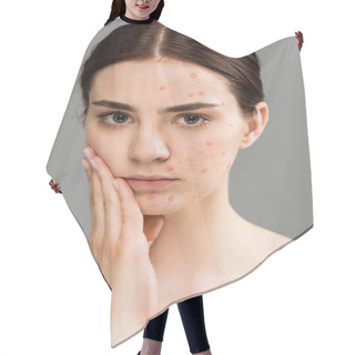 Personality  Sad Brunette Woman With Pimples Touching Face Isolated On Grey  Hair Cutting Cape