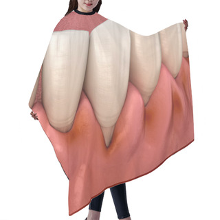 Personality  Gingivitis Inflammation Of The Gums. Dental 3D Illustration Hair Cutting Cape