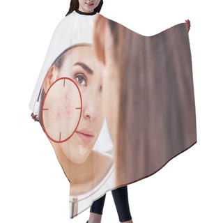 Personality  Young Woman With Acne Skin In Red Aim. Hair Cutting Cape