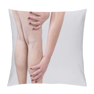 Personality  The Varicose Veins On A Legs Of Woman Pillow Covers