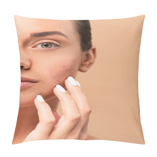 Personality  Cropped View Of Girl Touching Face With Problem Skin And Looking At Camera Isolated On Beige  Pillow Covers