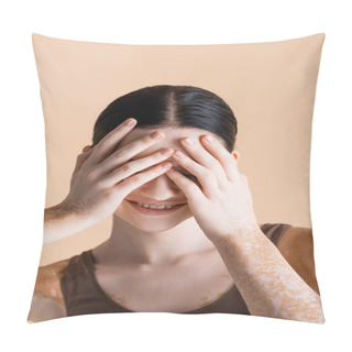 Personality  Smiling Young Beautiful Woman With Vitiligo Covering Eyes Isolated On Beige Pillow Covers