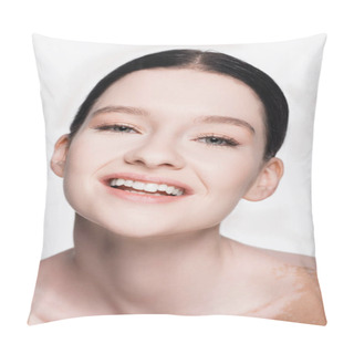 Personality  Smiling Young Beautiful Woman With Vitiligo Isolated On White Pillow Covers