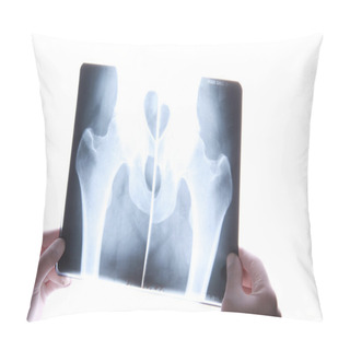Personality  Xray Picture Pillow Covers