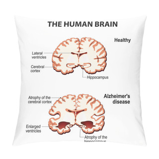 Personality  The Human Brain.  Pillow Covers