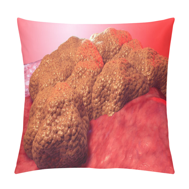 Personality  Cancer Cell Tumor, 3d Medical Illustration Pillow Covers