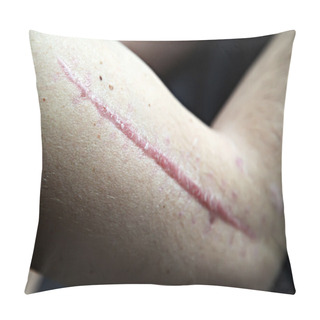 Personality  Scar On Human Skin Pillow Covers