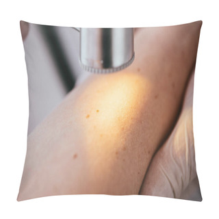 Personality  Close Up Of Dermatologist Holding Dermatoscope While Examining Hand Of Patient With Melanoma  Pillow Covers