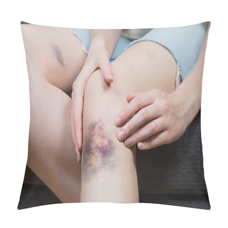 Personality  Checking Bruise Injury On Young Woman Knee Pillow Covers