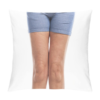 Personality  Fat And Cellulite On The Legs. Pillow Covers