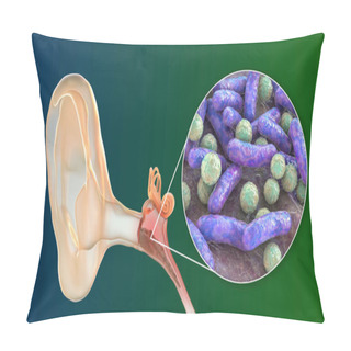 Personality  Otitis Media, An Inflammatory Disease Of The Middle Ear, And Close-up View Of Bacteria, The Causative Agent Of Otitis, 3D Illustration Pillow Covers