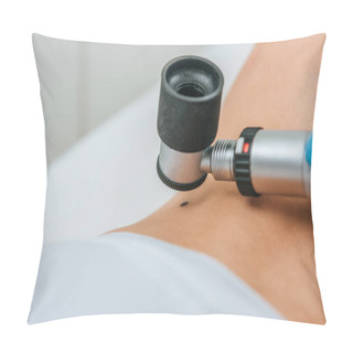 Personality  Cropped View Of Doctor Using Magnifier During Mole Removal Procedure Pillow Covers