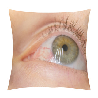 Personality  Close-up Of A Woman's Green Eye With Burst Blood Vessels, Macrophotography Pillow Covers