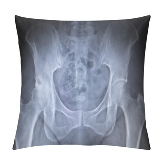 Personality  X-ray Orthopedic Scan  Image Of Hip Joints Human Skeleton Pillow Covers
