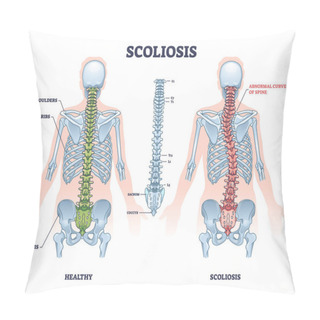 Personality  Scoliosis As Medical Sideways Curvature Illness Of Spine Outline Diagram. Labeled Educational Scheme With Healthy And Abdominal Backbone Skeleton Comparison Vector Illustration. Deformity Posture. Pillow Covers