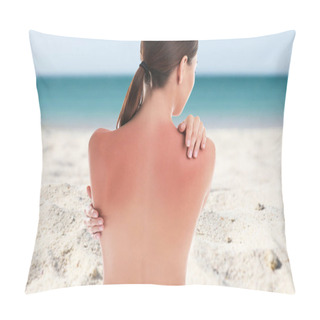 Personality  Woman With Sunburn On Beach. Skin Protection From Sun In Summer Pillow Covers