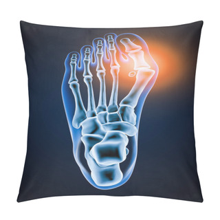 Personality  Hallux Valgus Or Bunion 3D Rendering Illustration. Superior Or Dorsal View Of Accurate Human Left Foot Bones With Body Contours On Blue Background. Anatomy, Osteology, Pahtology, Orthopedics Concept. Pillow Covers