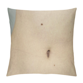 Personality  Belly Of A Girl With A Navel And Sideways Side Close-up, With Lots Of Moles On The Skin Pillow Covers