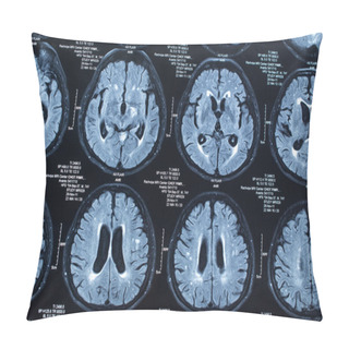 Personality  Research In Medicine. CT Scan Of The Patient. Pillow Covers