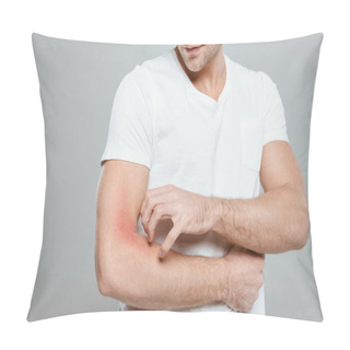 Personality  Cropped View Of Man Scratching Hand With Allergy Isolated On Grey Pillow Covers