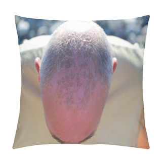 Personality  Solar Burns On The Male Head Pillow Covers