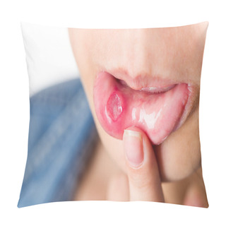 Personality  Woman With Serious Aphtha Pillow Covers