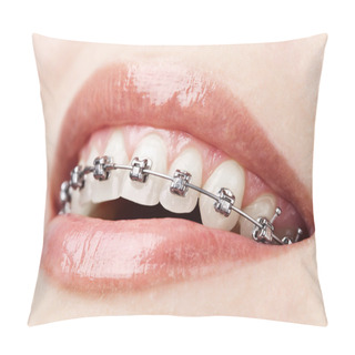Personality  Teeth With Braces Pillow Covers