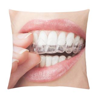Personality  Teeth With Whitening Tray Pillow Covers